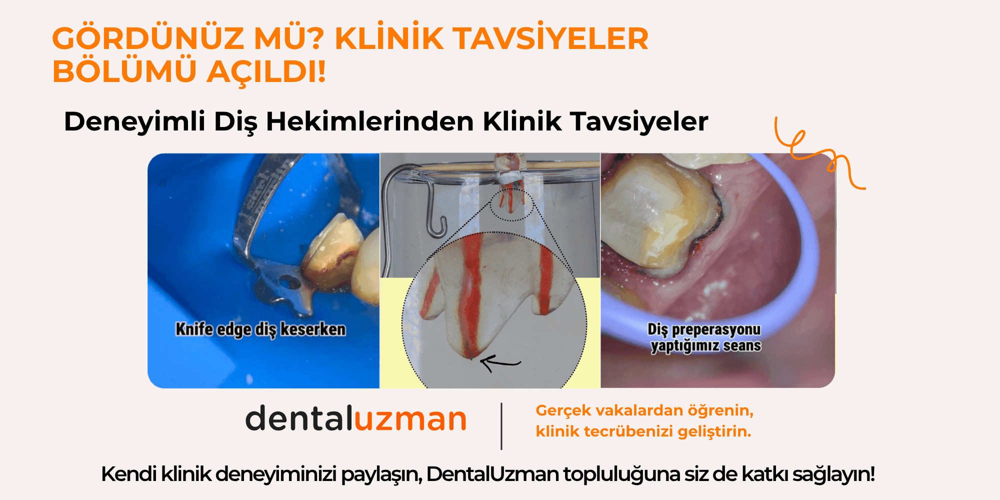 Klinik Tavsiyeler Bölümü Açıldı – Siz de Katkı Sağlayın!