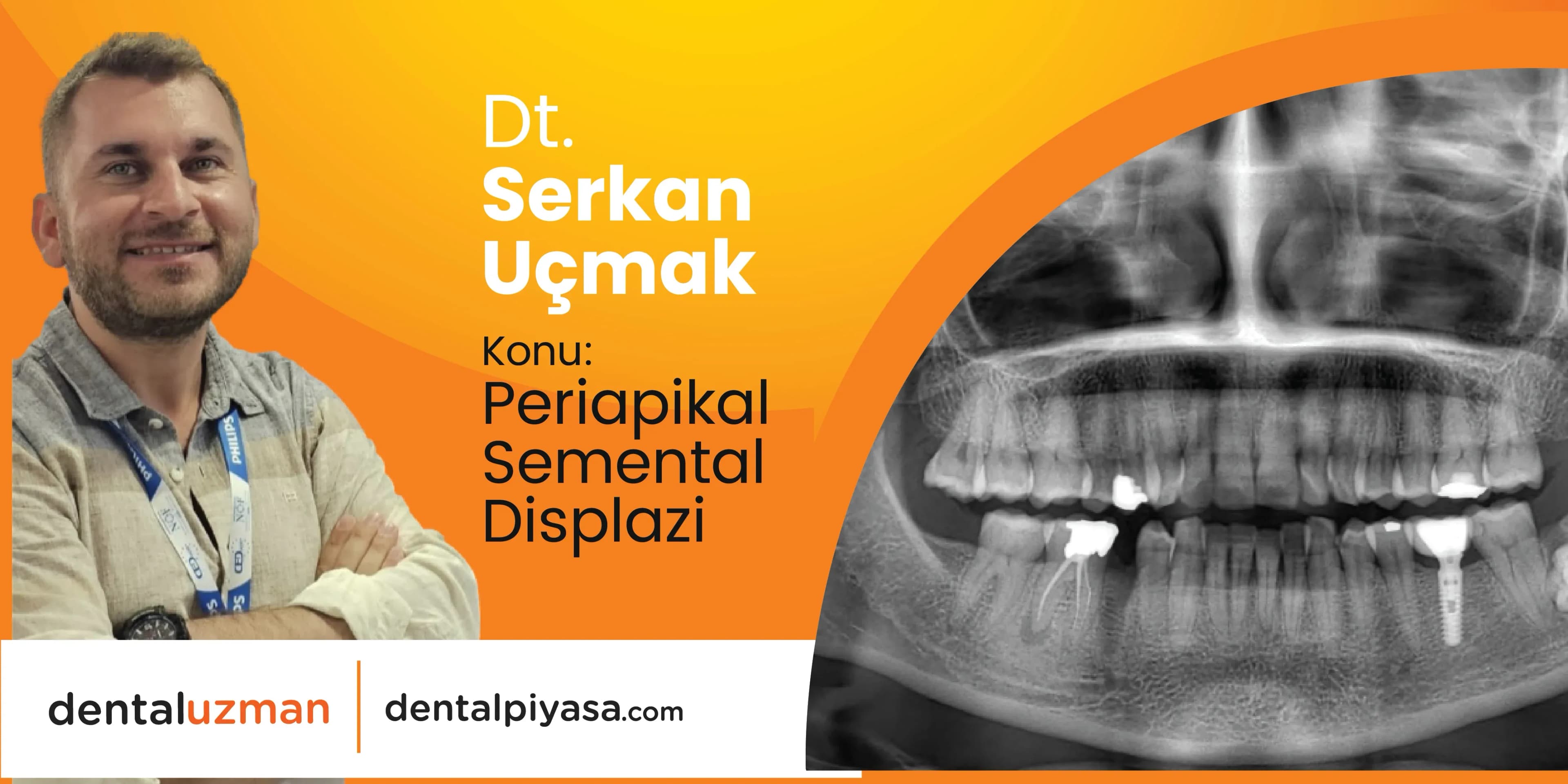 Periapikal Semental Displazi (PSD) - Uzm. Dt.Serkan Uçmak