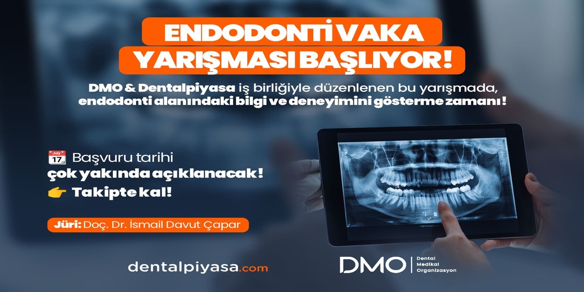 Endodonti Vaka Yarışması Çok Yakında Başlıyor !