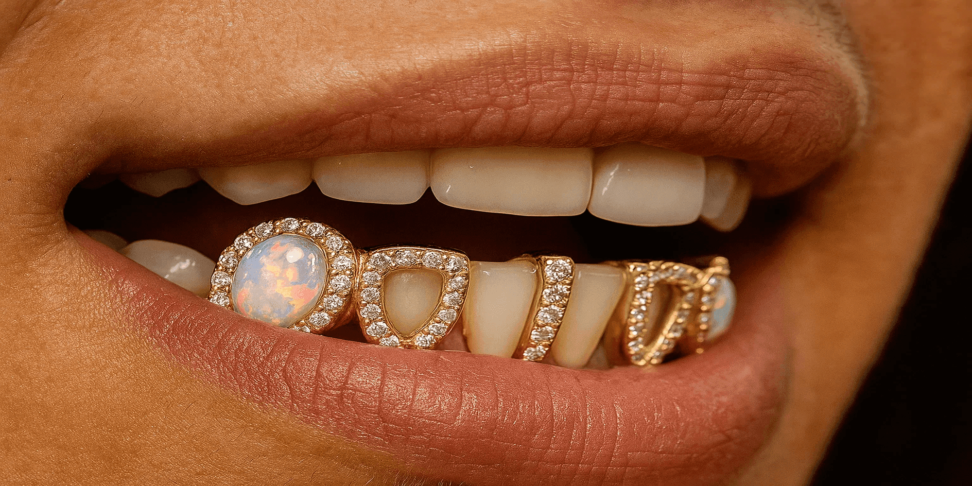 Diş Mücevherleri ve Grillzler: Ağız Sağlığına Etkisi Nedir?
