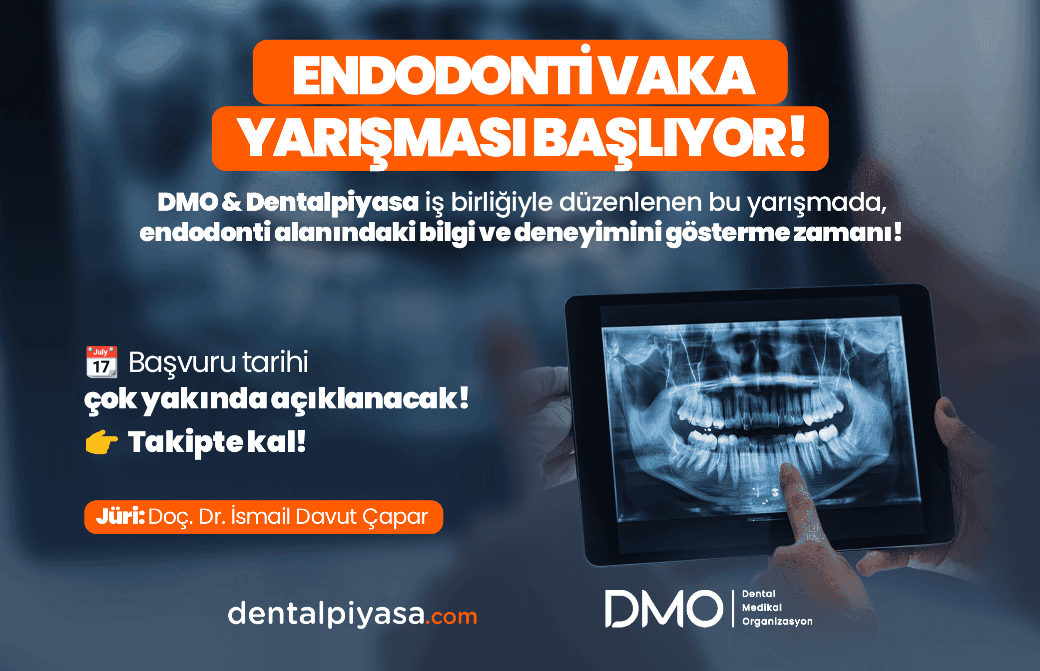 Endodonti Vaka Yarışması Çok Yakında Başlıyor ! - Görsel 1