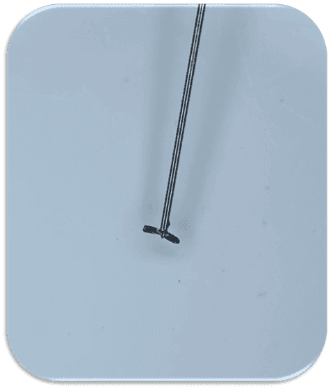 Kök Ucundan Taşmış Kırık Eğeye Sahip Alt Çene Büyükazı Dişinin Endodontik Yönetimi - Uzm. Dt. Yahya Güven - Görsel 8