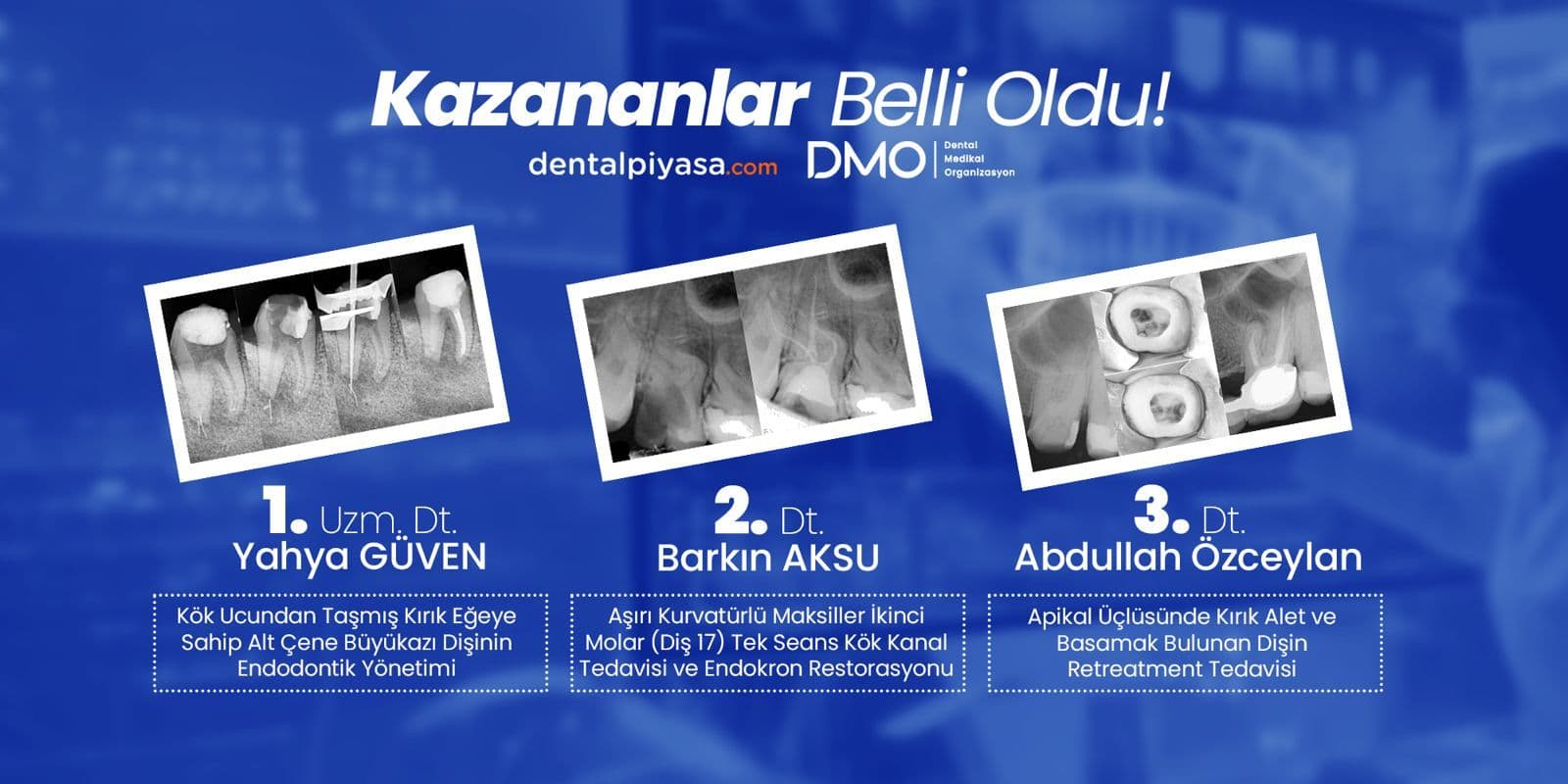 DentalUzman Endodonti Vaka Yarışması – Kazananlar Belli Oldu !